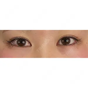 藤・ナチュレ美容クリニック 藤・ナチュレ美容クリニック 銀座院口コミ