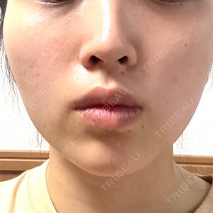 TCB東京中央美容外科 TCB東京中央美容外科 中野院口コミ