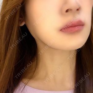 LOUIS CLINIC 二子玉川院【ルイクリニック】口コミ