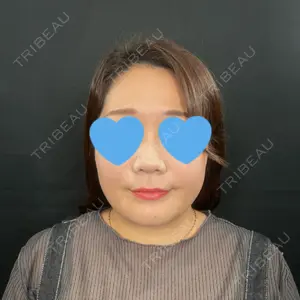 口コミ