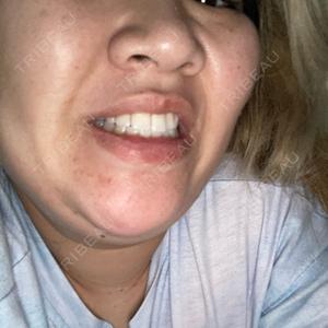 目白ホワイトクリニック口コミ