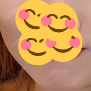 BiBiクリニック口コミ