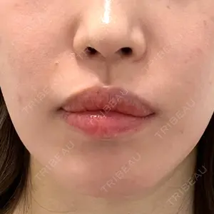 ルラ美容クリニック ルラ美容クリニック 大阪本院口コミ