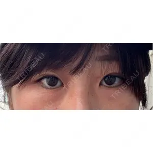 APOLLO BEAUTY CLINIC口コミ