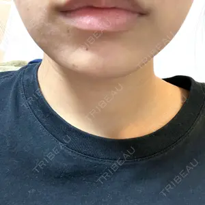 口コミ