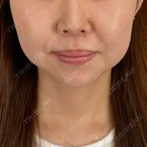 口コミ