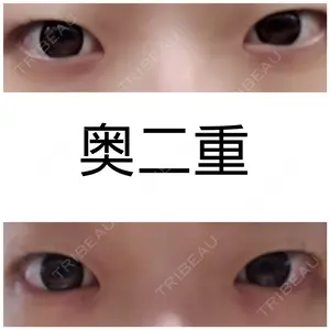 湘南美容クリニック 湘南美容クリニック 新宿本院口コミ