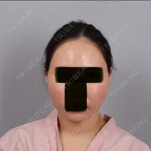 セギム美容整形外科口コミ