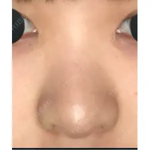 LUHO（ルホ）美容外科口コミ
