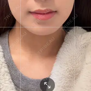 BiBiクリニック口コミ