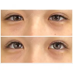 藤・ナチュレ美容クリニック 藤・ナチュレ美容クリニック 銀座院口コミ
