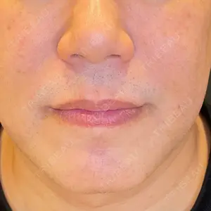 LOUIS CLINIC 二子玉川院【ルイクリニック】口コミ