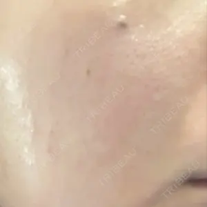 APスキンクリニック銀座口コミ