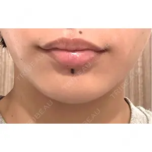 湘南美容クリニック 湘南美容クリニック 新宿本院口コミ