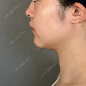 口コミ