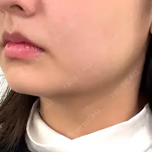 口コミ