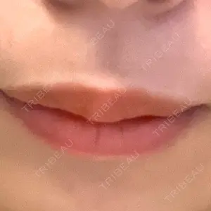 口コミ