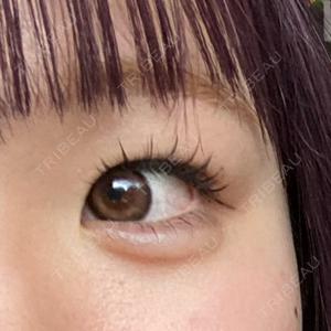銀座美容外科クリニック 銀座美容外科クリニック 新宿院口コミ