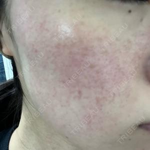 NARU Beauty Clinic NARU Beauty Clinic 【ナルクリ】口コミ