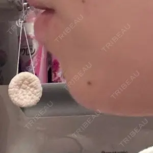 口コミ