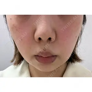 口コミ