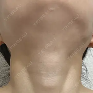 BiBiクリニック口コミ