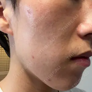 東京素肌クリニック 東京素肌クリニック 銀座本院口コミ