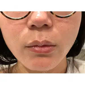 口コミ