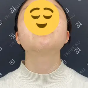EMMO FACE CLINIC EMMO FACE CLINIC 大阪梅田院口コミ