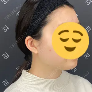 EMMO FACE CLINIC EMMO FACE CLINIC 大阪梅田院口コミ