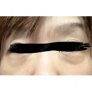 HAAB×DREAM BEAUTY CLINIC HAAB×DREAM BEAUTY CLINIC 東京本院口コミ
