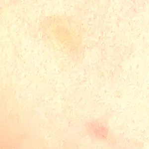 Fellez Clinic【フェルズクリニック】口コミ
