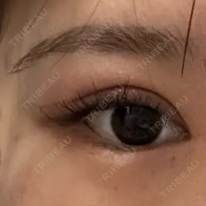 東京BELLEZZAクリニック口コミ