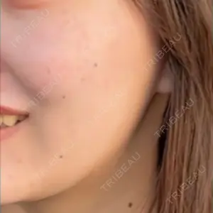 Mavie Beauty Clinic （マヴィービューティークリニック）口コミ