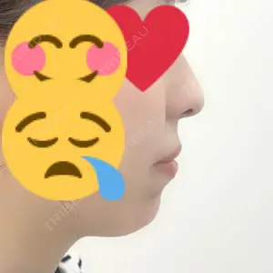 TCB東京中央美容外科 TCB東京中央美容外科 新宿東口院口コミ