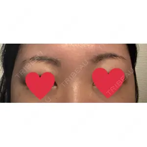 APスキンクリニック銀座口コミ