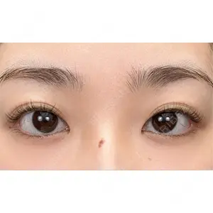 湘南美容クリニック 湘南美容クリニック 池袋東口院口コミ
