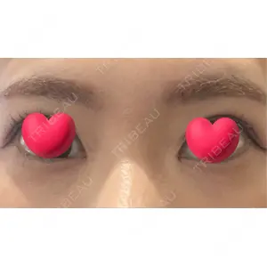 HAAB×DREAM BEAUTY CLINIC HAAB BEAUTY CLINIC 名古屋院口コミ