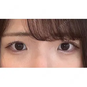 東京シンデレラ美容外科 東京シンデレラ美容外科 池袋院口コミ