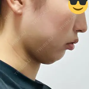 口コミ