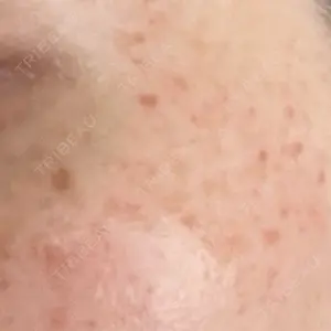 口コミ
