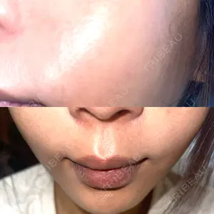 NARU Beauty Clinic NARU Beauty Clinic 【ナルクリ】口コミ