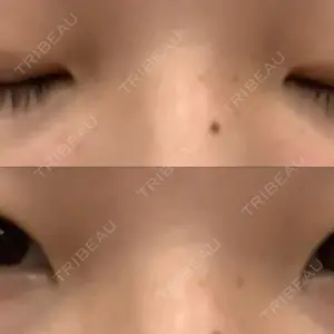 口コミ