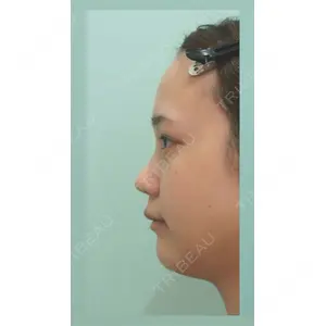 口コミ