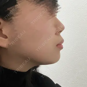 銀座みゆき通り美容外科 銀座みゆき通り美容外科 大阪梅田院口コミ