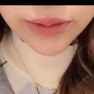 R Beauty CLINIC R Beauty CLINIC 銀座院口コミ