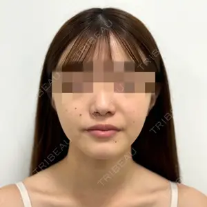 口コミ