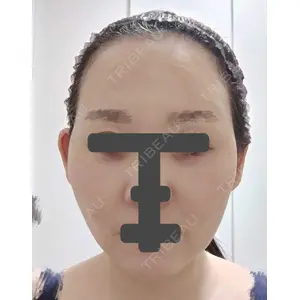 湘南美容クリニック 湘南美容クリニック 秋葉原院口コミ