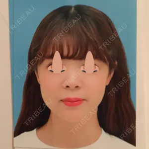 口コミ