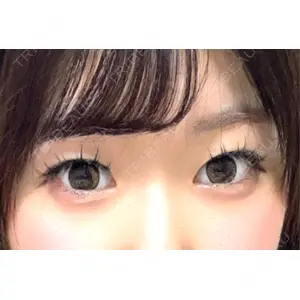 東京イセアクリニック口コミ